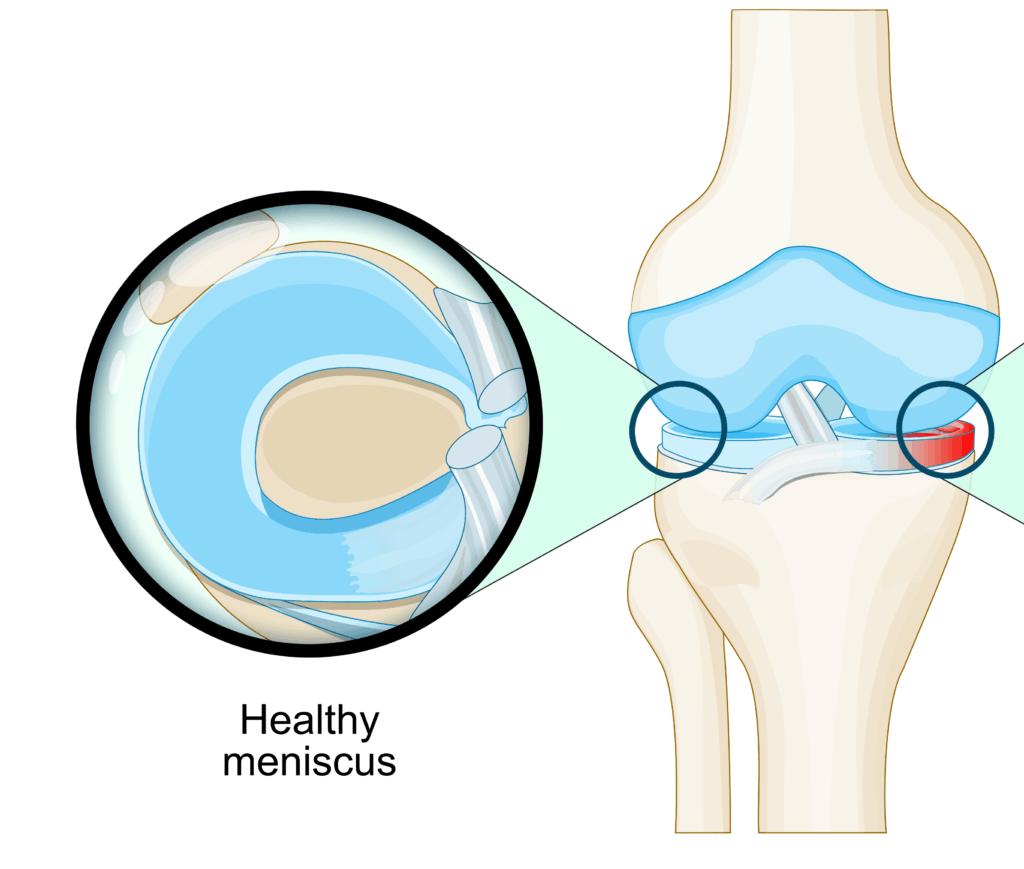 healthy-meniscus - Princeton Orthopaedic Associates