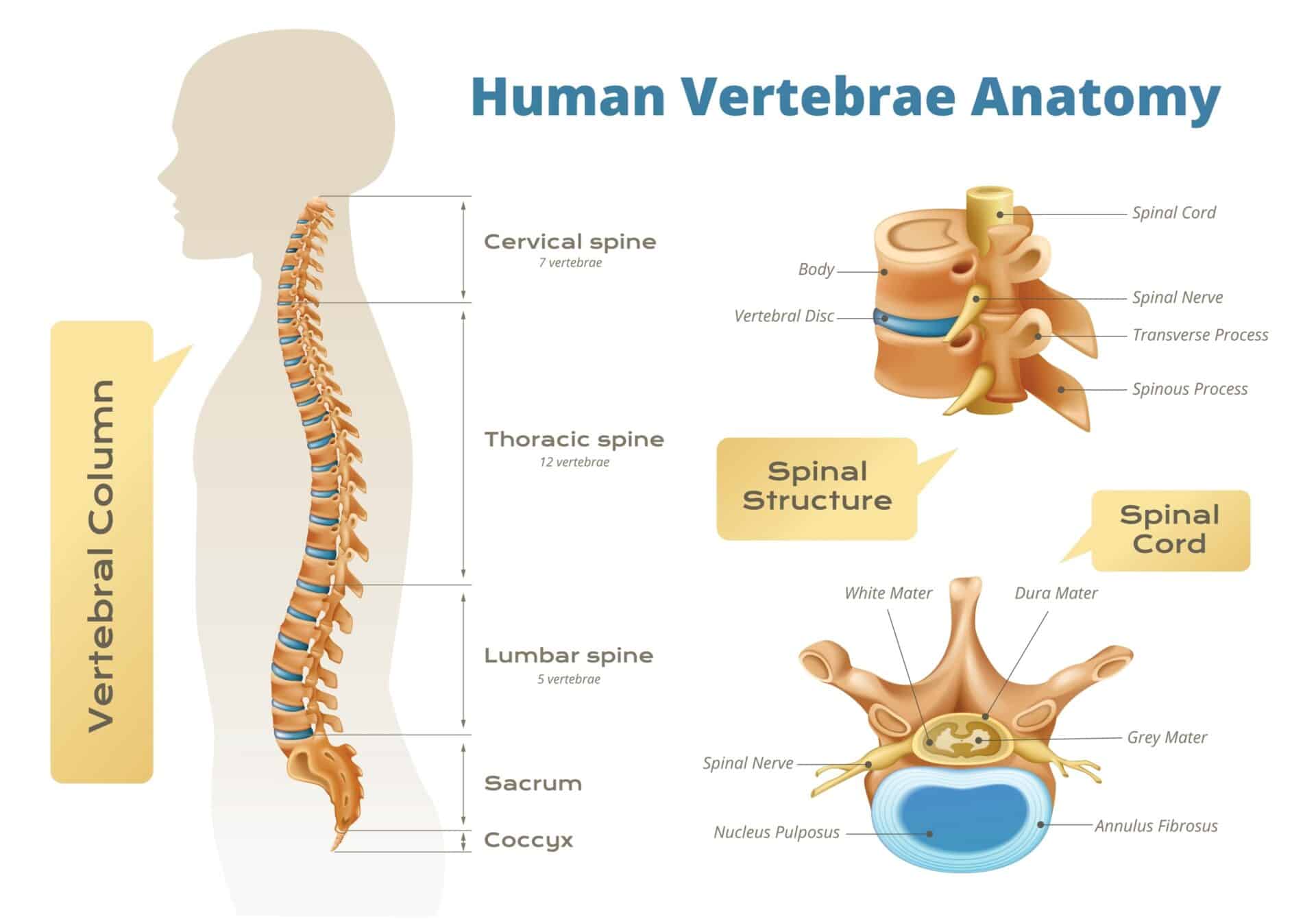 Rss Injection Lumbar Epidural Injections: What to Expect - Princeton Orthopaedic ...