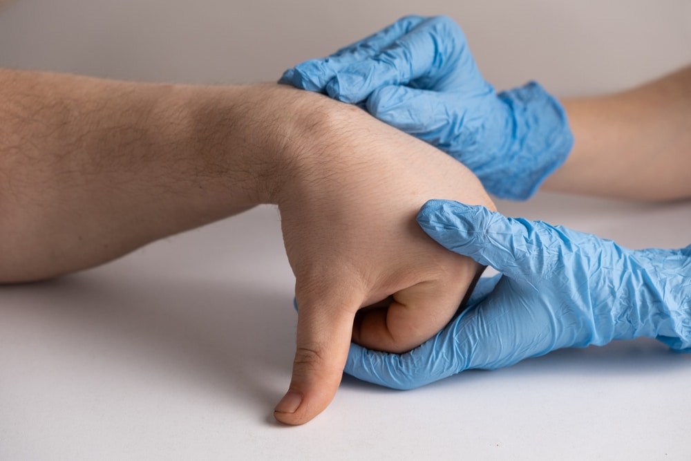 GanglionCystOrHygromaOfTheWristOnTheHand - Princeton Orthopaedic Associates