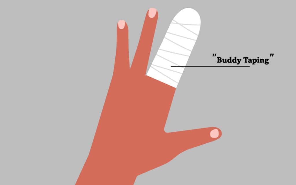 buddy-taping - Princeton Orthopaedic Associates