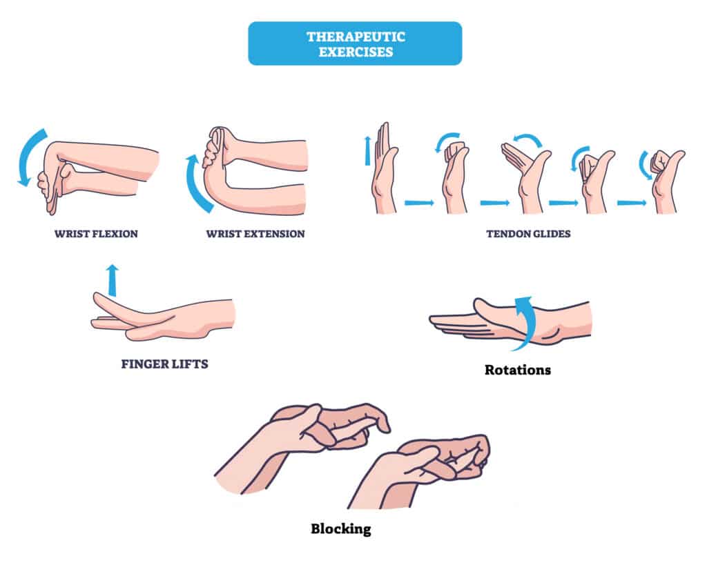 poa-hand-work - Princeton Orthopaedic Associates