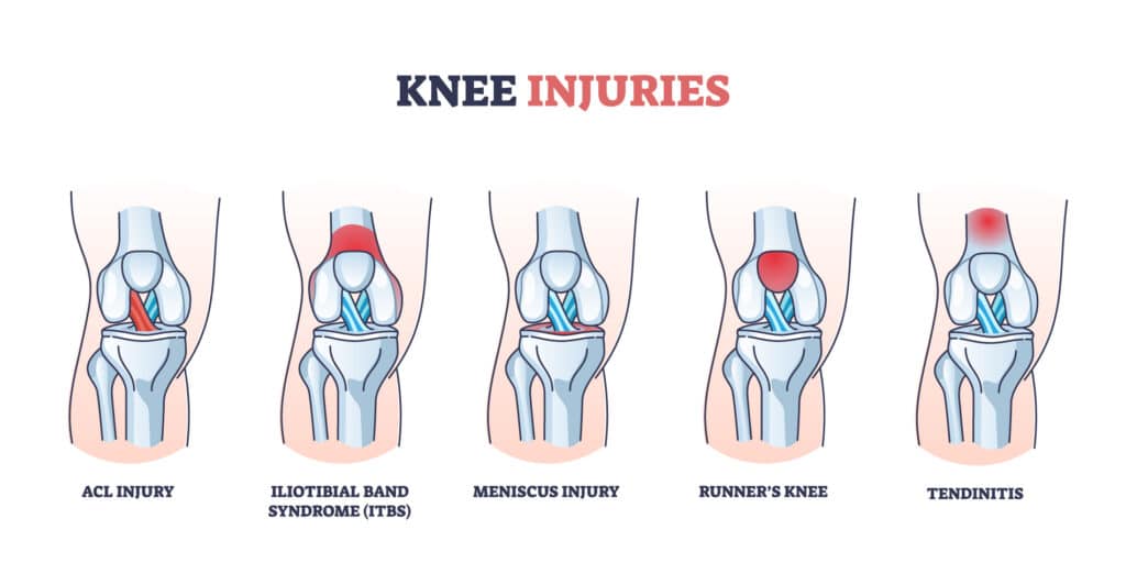 poa-knee-injuries - Princeton Orthopaedic Associates