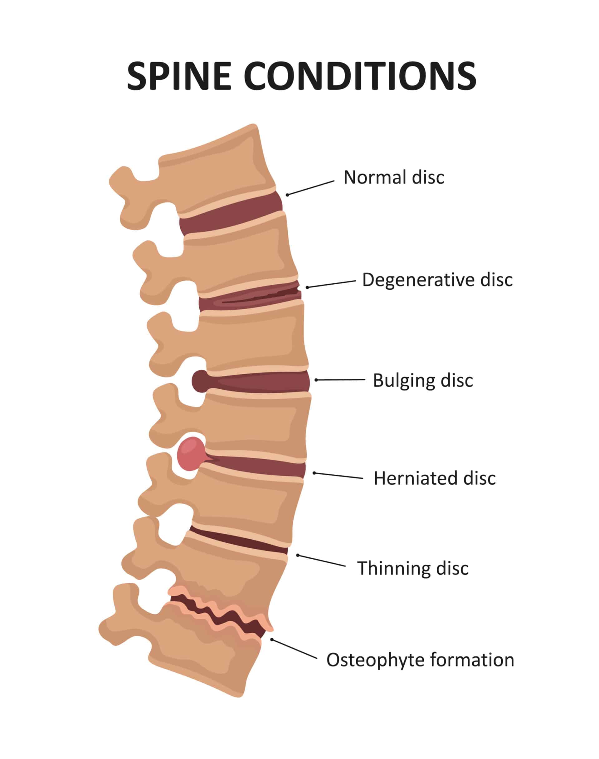 Back Owner’s Guide to Relief - Princeton Orthopaedic Associates