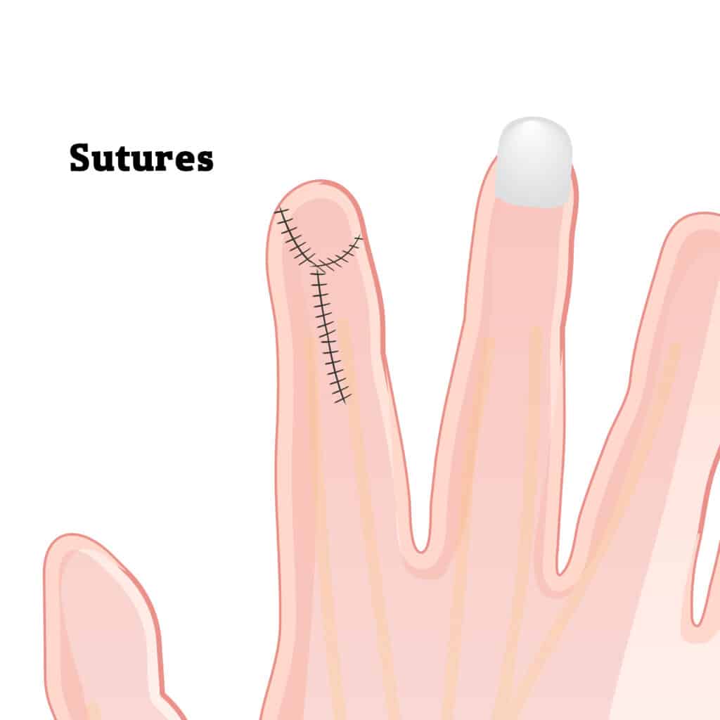 shutterstock_2161004843-Converted - Princeton Orthopaedic Associates